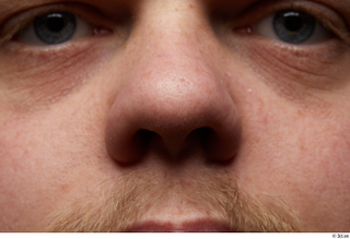 HD Face Skin Clifford Doyle face nose skin pores skin…